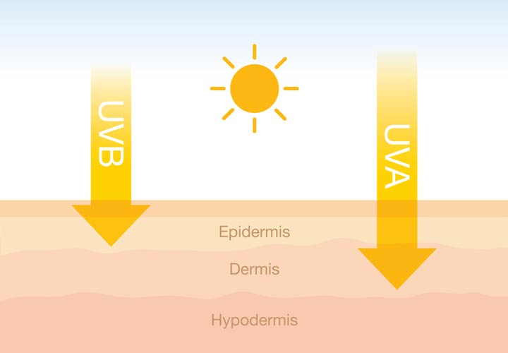Wirkungen von UV-Strahlen auf die Haut